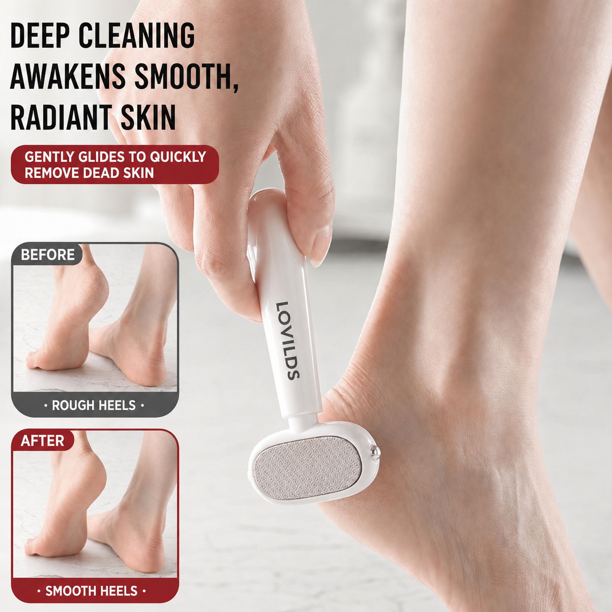 LOVILDS Dual‑Sided Foot Callus Remover